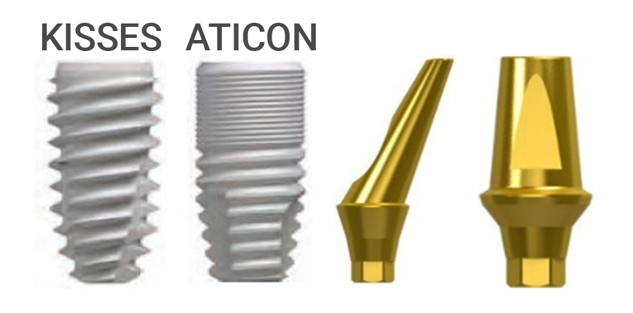 Имплантаты Kisses и Aticon